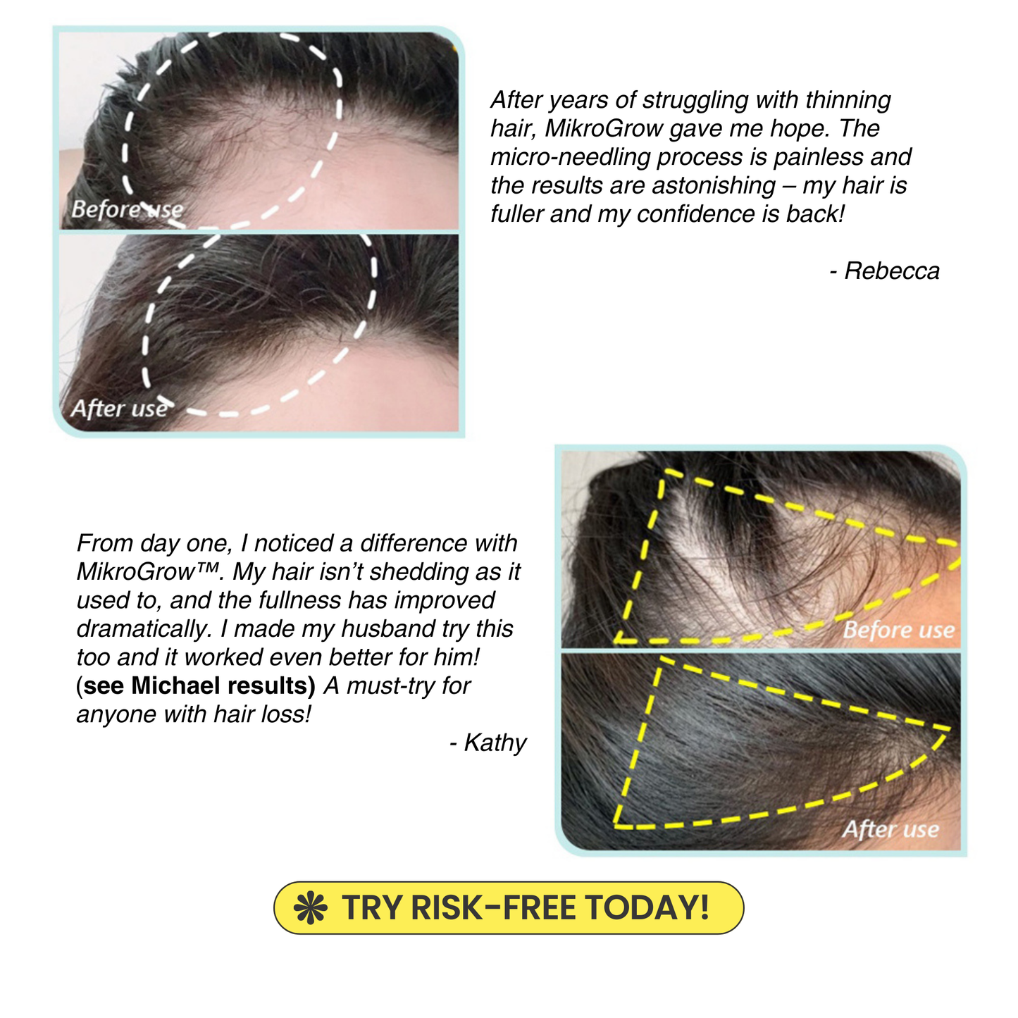 Mikro Re:Grow 30-Day Hair Regrowth System