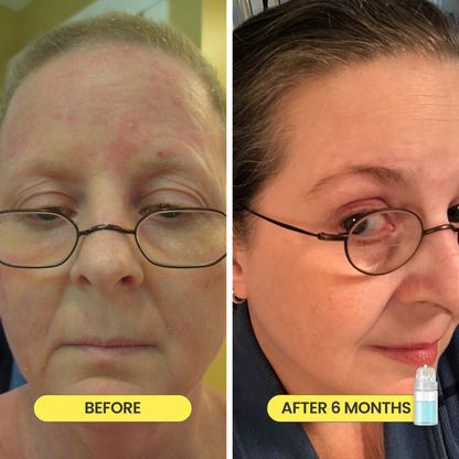 Mikro Re:Grow 30-Day Hair Regrowth System